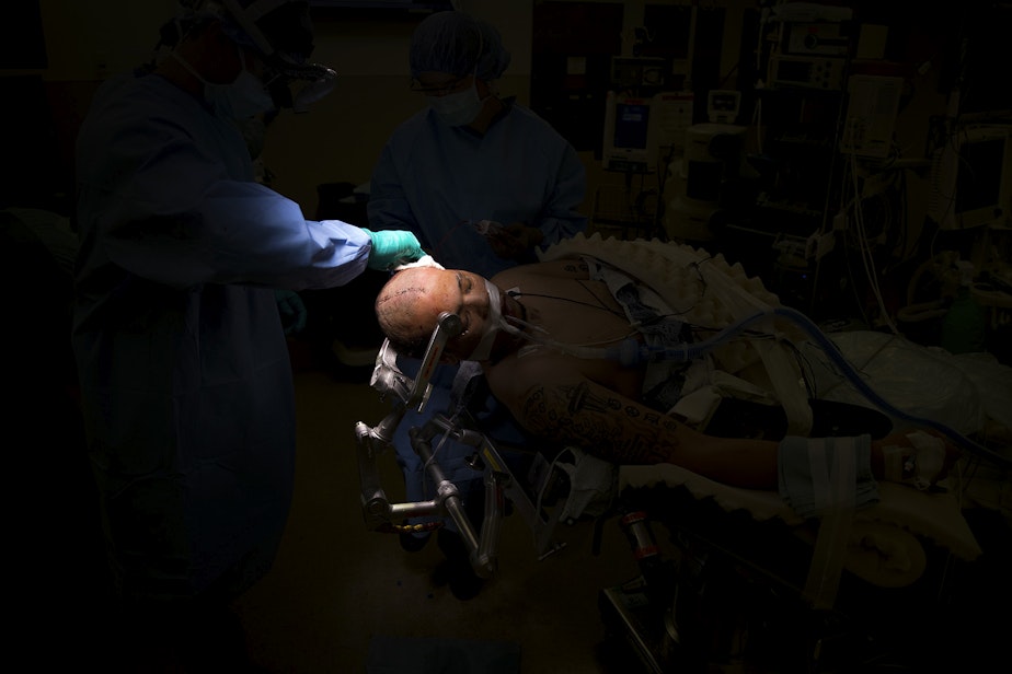 caption: Surgeons complete DaShawn Horne's cranioplasty surgery, where the portion of his skull that was removed in January was returned, on Thursday, June 28, 2018, at Harborview Medical Center in Seattle. His cranial bone was stored in a freezer bank for five months.