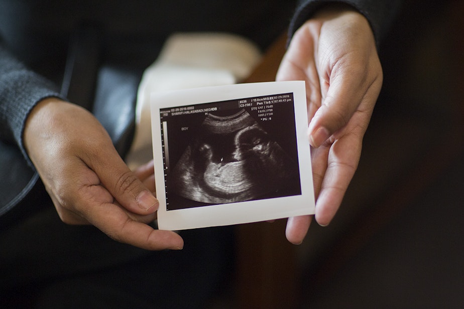 caption: Neda Sharifi Khalafabadi shows a picture of her sonogram.